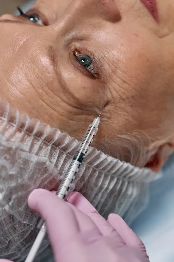 Close-up of the eye area during a non-surgical eyelid rejuvenation assessment