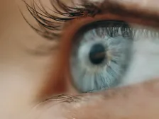 Close-up of an eye showing eyelashes turned inward toward the cornea