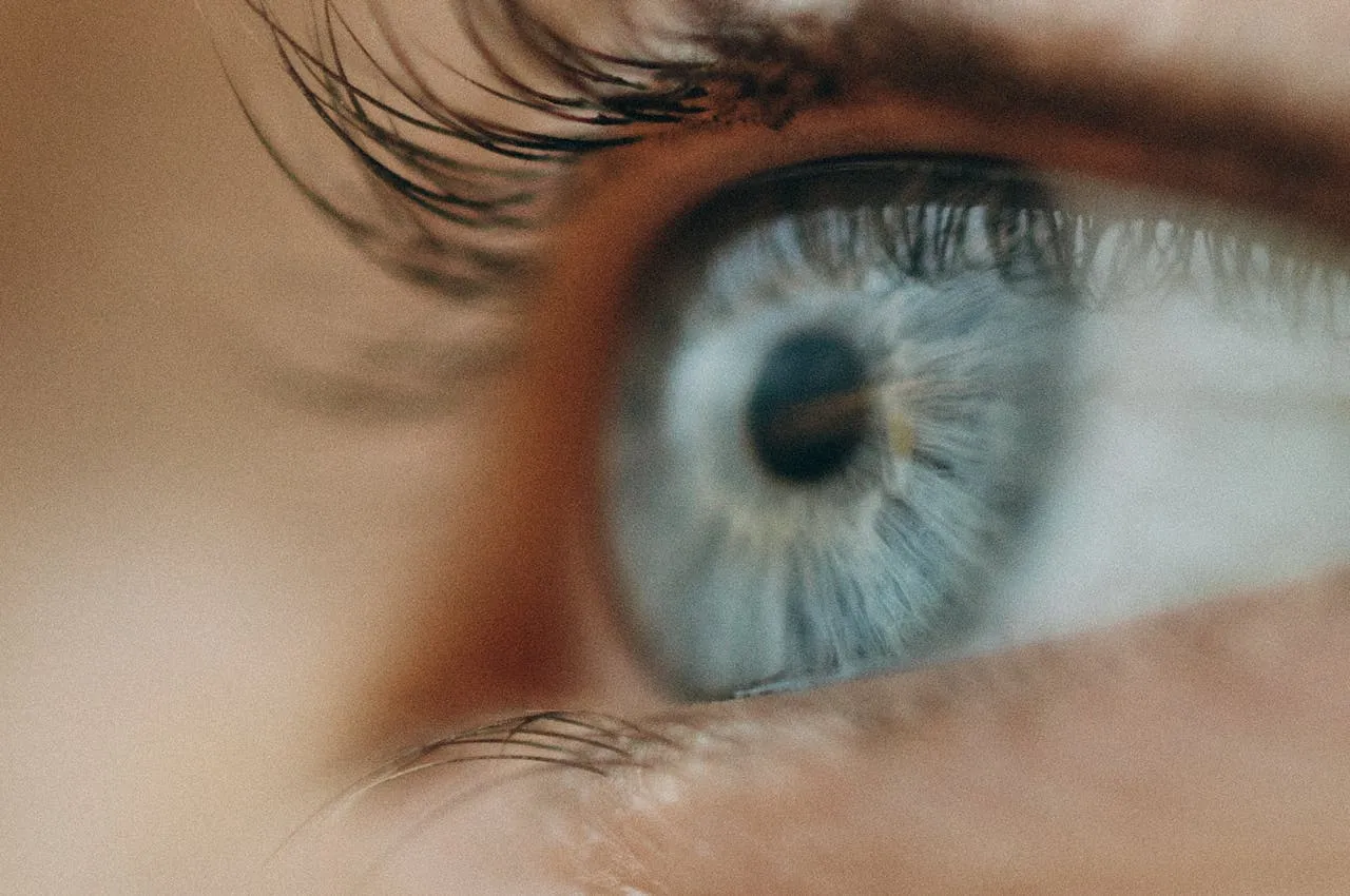 Close-up of an eye showing eyelashes turned inward toward the cornea