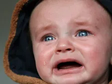 Infant with a watery eye from a blocked tear duct