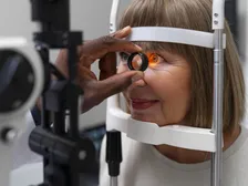 Optical coherence tomography scan of the optic nerve used to detect glaucoma damage