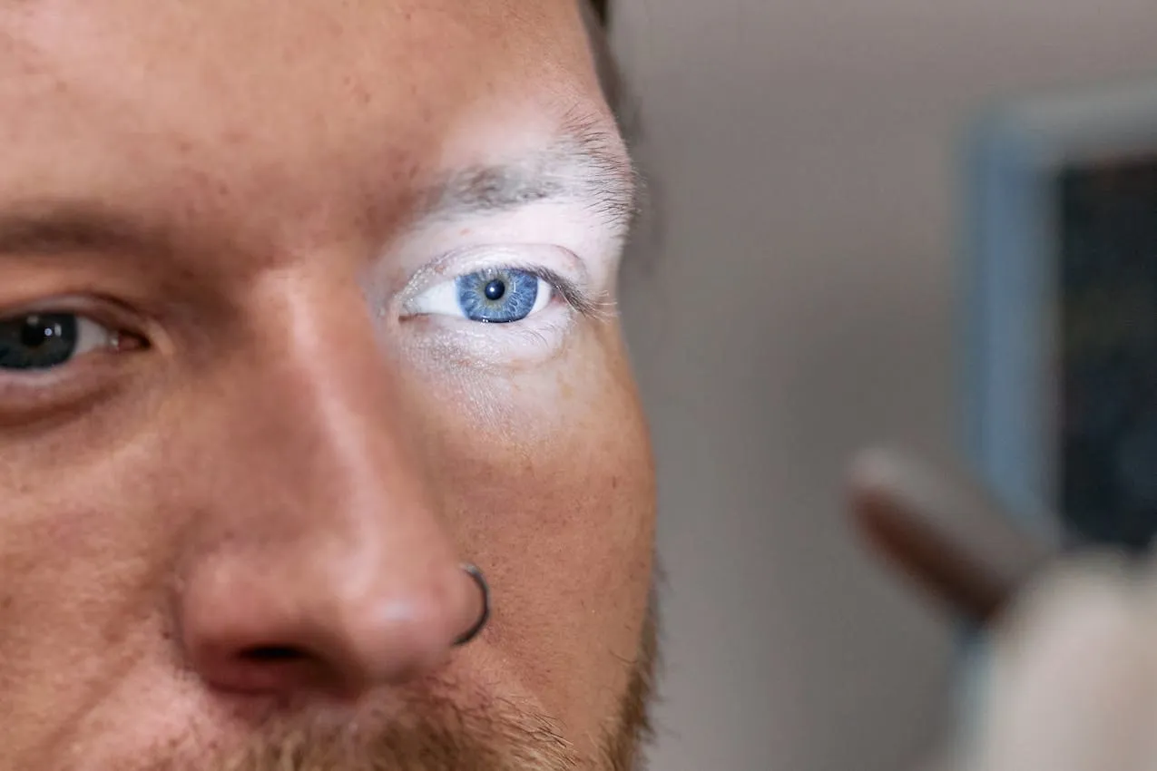Lower eyelid turned outward away from the eye surface in ectropion