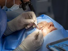 Close-up of an eyelid showing a small mass before surgical excision