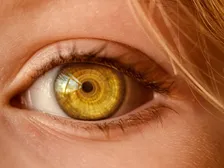 Amniotic membrane graft placed over a damaged ocular surface