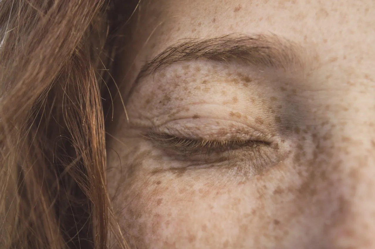 Close-up of a patient's eye area assessed for eyelid health and aesthetics
