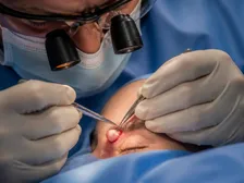 A firm rounded cyst near the outer edge of a child's eyebrow before excision