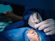 Intraocular lens fixated to the sclera where capsular support is absent