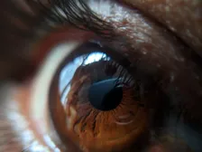 Probe dilating the punctum at the inner corner of the eyelid