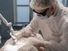 Excimer laser reshaping the cornea during refractive eye surgery
