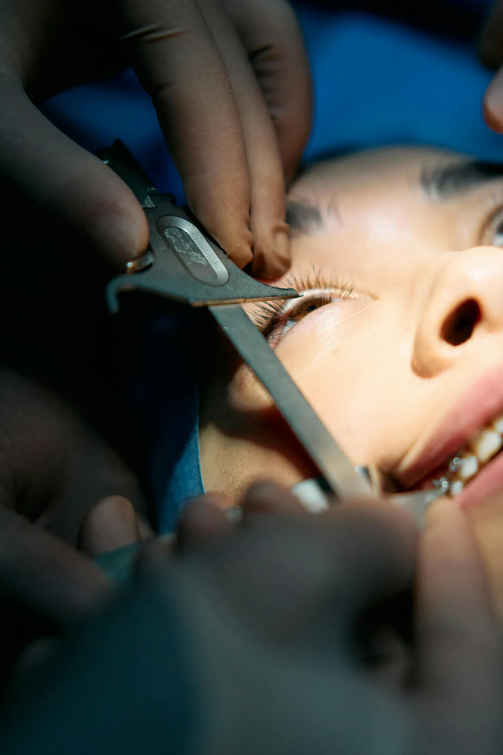 Vitrectomy surgery removing the vitreous gel to repair the retina
